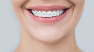 Problemy ortodontyczne 