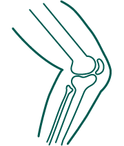 Osteotomia korekcyjna kolana