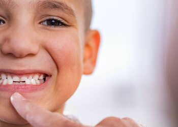 Genetyczny brak „dwójek” – jakie rozwiązania niesie nowoczesna stomatologia?
