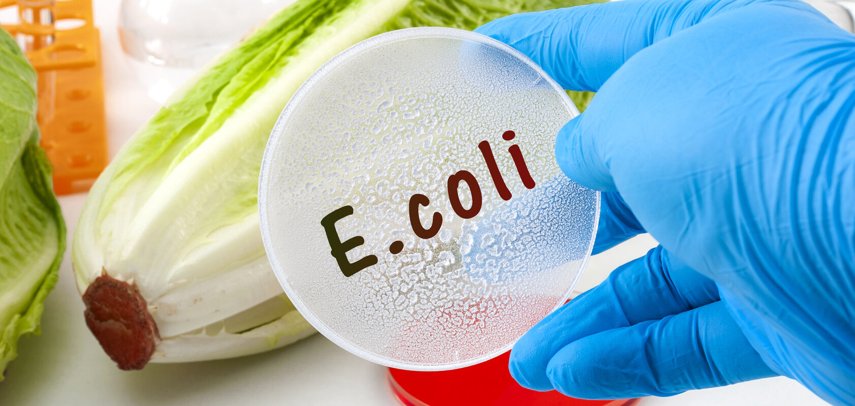 jest bakteria coli i kiedy stanowi zagrożenie?