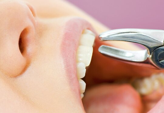 Martwy ząb: leczyć czy wyrwać?