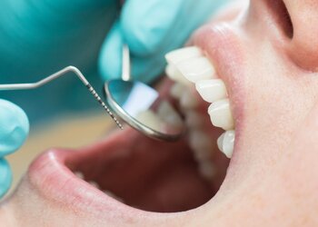 Suchy zębodół – przykra dolegliwość powstająca po usunięciu zęba